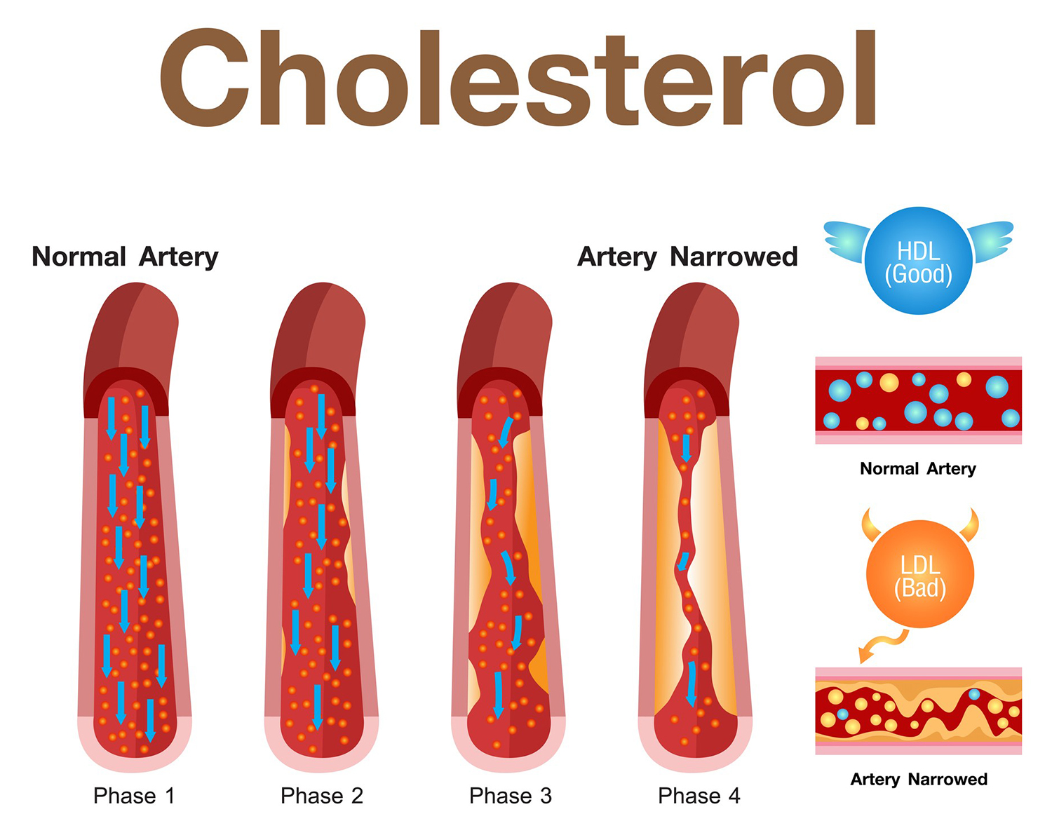 How To Calculate Total Cholesterol 