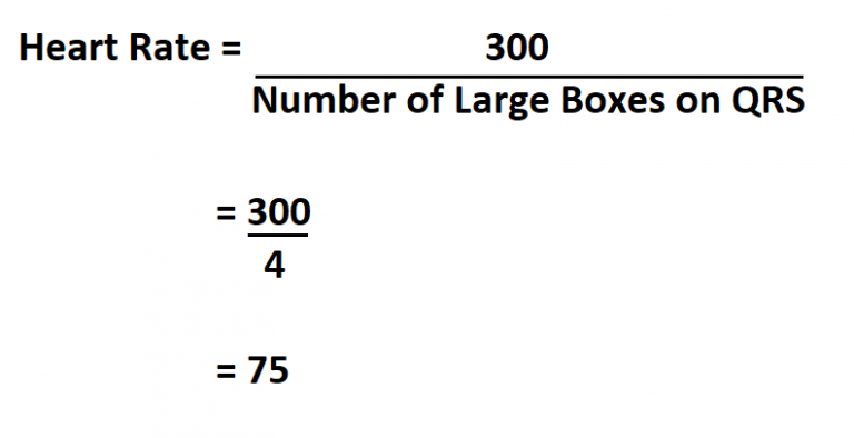 How to Calculate Heart Rate on ECG.